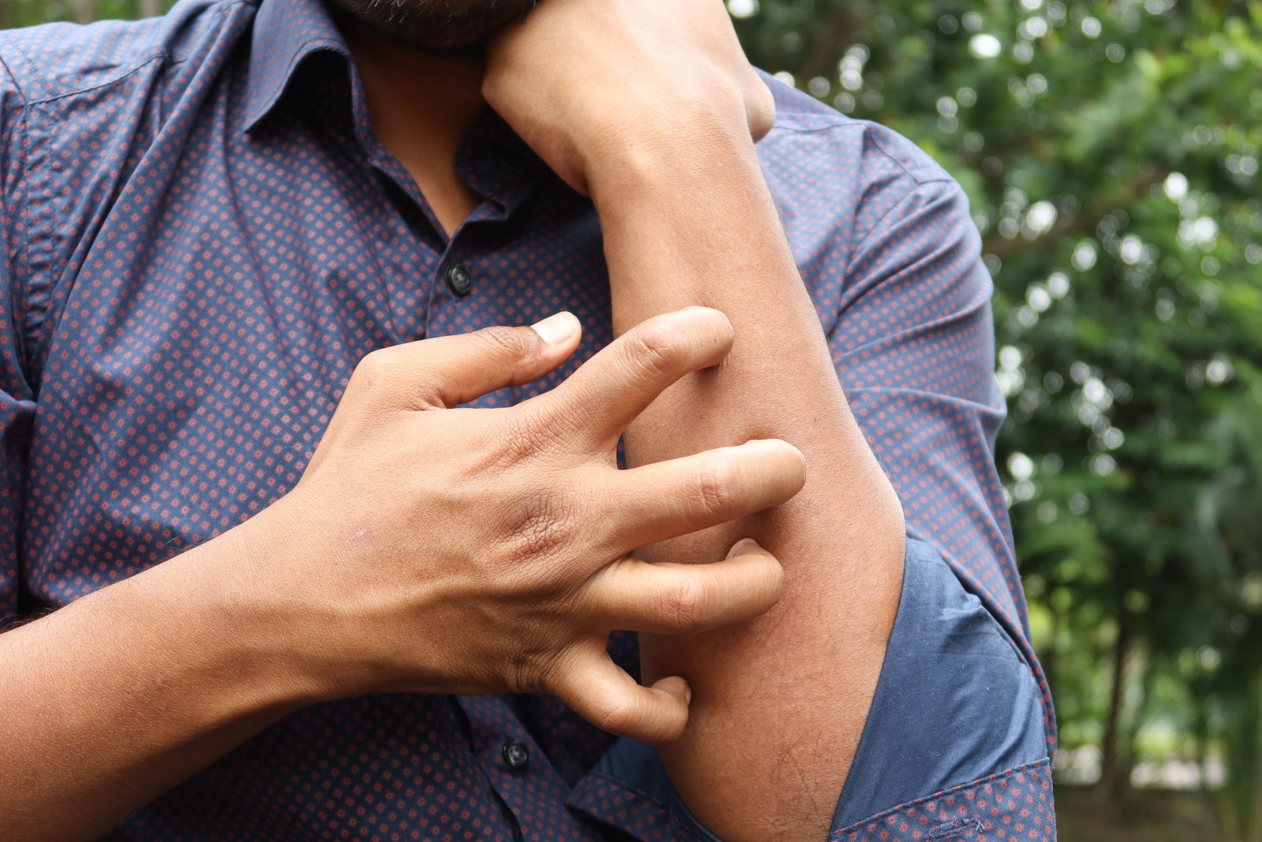 Homme se grattant le bras montrant une irritation cutanée